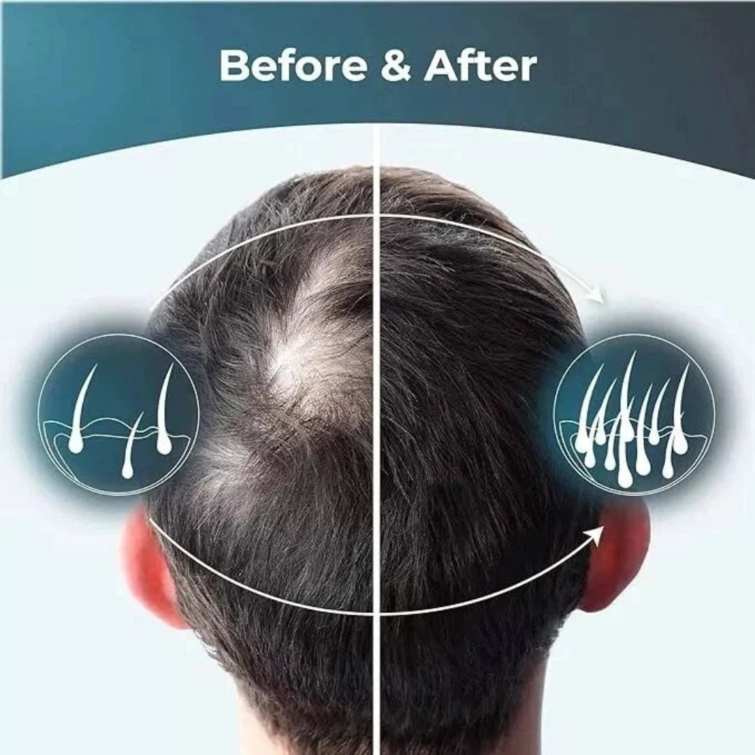 Before and after comparison of hair growth on a person's head with labeled hair follicles.