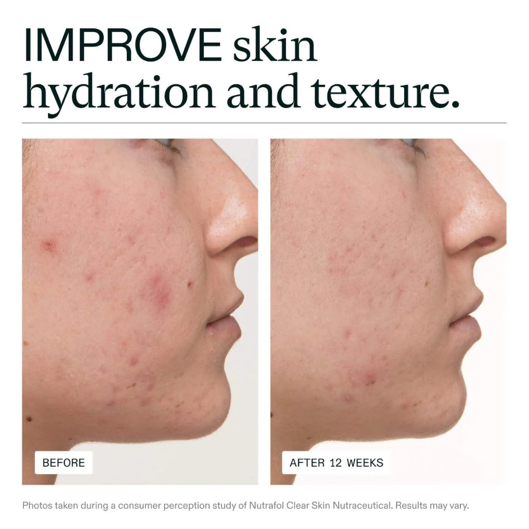 Before and after comparison of skin hydration and texture with text 'IMPROVE skin hydration and texture'.