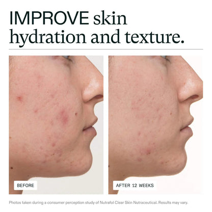 Before and after comparison of skin hydration and texture with text 'IMPROVE skin hydration and texture'.